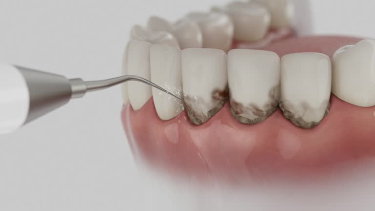 Trusted Wisdom Tooth Removal service in Palos Heights, IL - Dentist Open Now